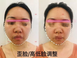 (魔力v脸保持多久)揭秘魔力V脸的秘密:打造完美轮廓的美容秘诀与实用技巧